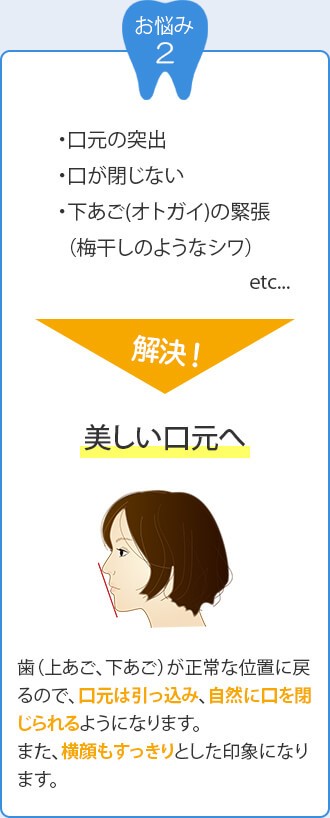 お悩み2